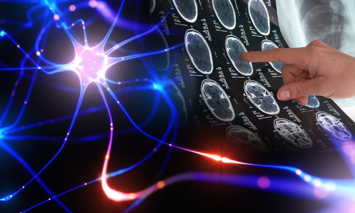 Ý thức con người vẫn hoạt động ngay cả khi cơ thể đã chết - H1