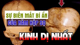Sự biến mất 13 hộp sọ kì dị nhất thế giới
