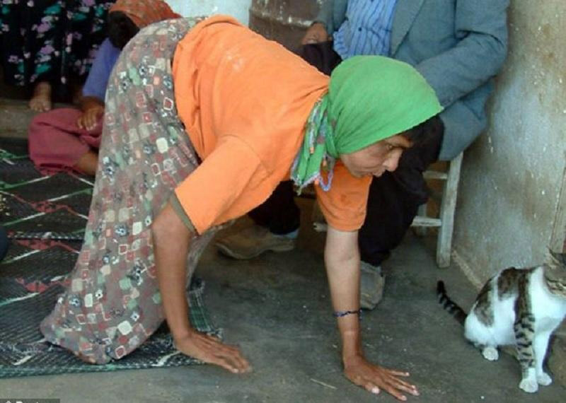 Thổ Nhĩ Kỳ: 5 anh em trong gia đình đi lại bằng 4 chi giống như gấu - ảnh 2